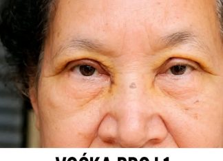 VOĆKA BROJ 1 PROTIV HOLESTEROLA, PRITISKA I MOŽDANOG UDARA: Ko je jede, bit će zdrav kao drijen