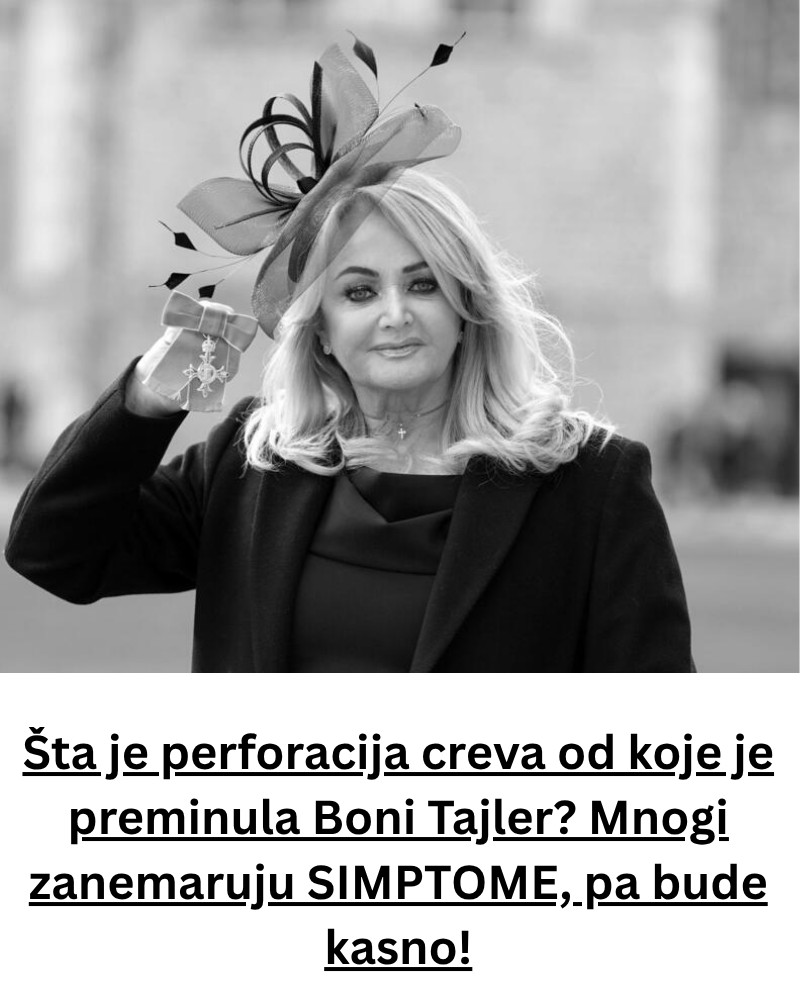 Šta je perforacija creva od koje je preminula Boni Tajler? Mnogi zanemaruju SIMPTOME, pa bude kasno! - featured image Šta je perforacija creva od koje je preminula Boni Tajler? Mnogi zanemaruju SIMPTOME, pa bude kasno! - featured image