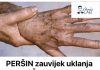 PERŠIN Zauvijek Uklanja STARAČKE MRLJE! Ovo Morate Napraviti… - featured image