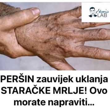 PERŠIN Zauvijek Uklanja STARAČKE MRLJE! Ovo Morate Napraviti… - featured image
