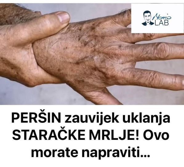 PERŠIN Zauvijek Uklanja STARAČKE MRLJE! Ovo Morate Napraviti… - featured image