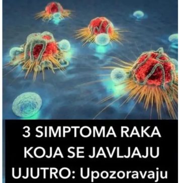 3 SIMPTOMA RAKA KOJA SE JAVLJAJU UJUTRO Upozoravaju na metastaze 3 SIMPTOMA RAKA KOJA SE JAVLJAJU UJUTRO Upozoravaju na metastaze - featured image