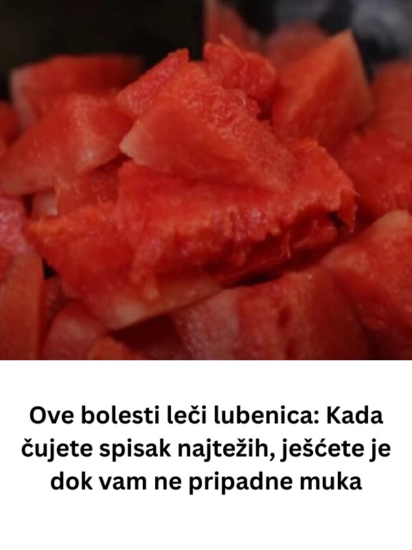 Ove bolesti liječi lubenica: Kada čujete spisak najtežih, jest ćete je dok vam ne bude muka! (FOTO) - featured image