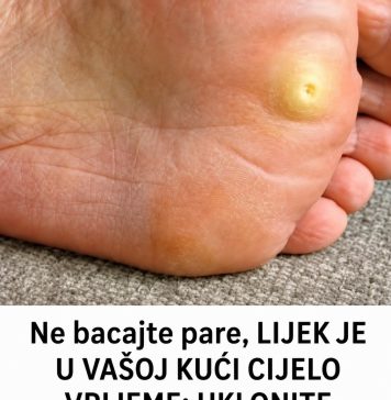 Ne bacajte pare, LIJEK JE U VAŠOJ KUĆI CIJELO VRIJEME: UKLONITE KURIJE OKO ZA SAMO 2 DANA Ne bacajte pare, LIJEK JE U VAŠOJ KUĆI CIJELO VRIJEME: UKLONITE KURIJE OKO ZA SAMO 2 DANA - featured image