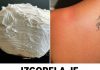 Izgorela je na suncu, a ovo ju je spasilo za 30 minuta: Svi to imamo u kući, a nije jogurt - featured image