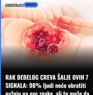 Rani simptomi raka debelog creva: 1 izgleda bezopasno, a baš njega većina ljudi svakog dana ignoriše - featured image