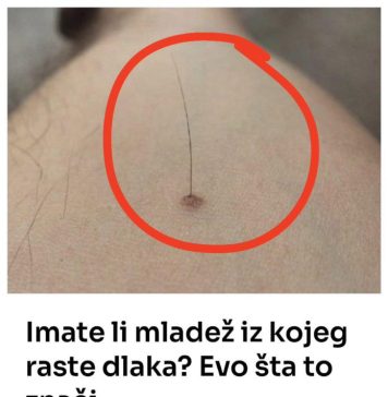 Evo šta tačno znači kada vam iz mladeža raste dlaka: Da li je to opasno, iznenadit ćete se - featured image
