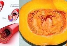 I DOKTORI GA KORISTE: Uz ovaj recept recite ZBOGOM povišenom holesterolu, šećeru u krvi, masnoćama i trigliceridima! - featured image