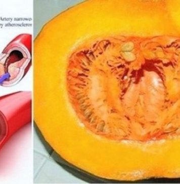 I DOKTORI GA KORISTE: Uz ovaj recept recite ZBOGOM povišenom holesterolu, šećeru u krvi, masnoćama i trigliceridima! I DOKTORI GA KORISTE: Uz ovaj recept recite ZBOGOM povišenom holesterolu, šećeru u krvi, masnoćama i trigliceridima! - featured image