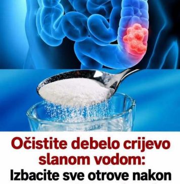 Očistite debelo crijevo slanom vodom: Izbacite sve otrove nakon zatvora i to u roku od 30 minuta! (RECEPT) - featured image