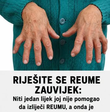 RIJEŠITE SE REUME ZAUVIJEK: Niti jedan lijek joj nije pomogao da izliječi REUMU, a onda je primjenila ovaj recept i ZAUVIJEK riješila svoj problem! - featured image