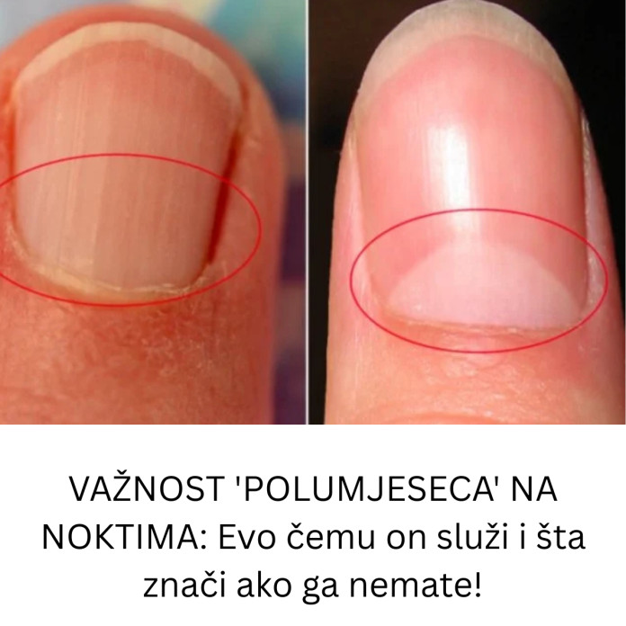 VAŽNOST ‘POLUMJESECA’ NA NOKTIMA: Evo čemu on služi i šta znači ako ga nemate! - featured image