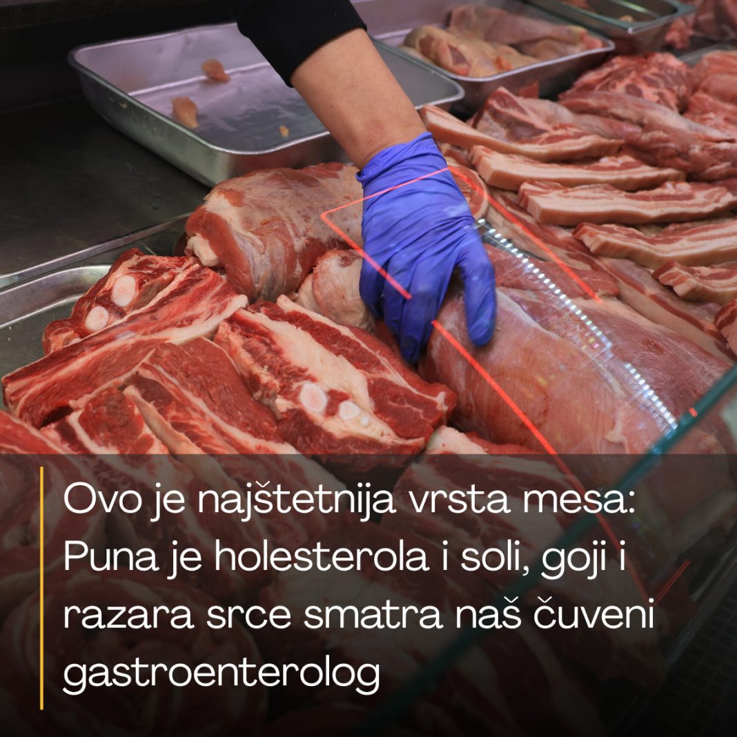 Ovo je najštetnija vrsta mesa: Puna je holesterola i soli, goji i razara srce smatra naš čuveni gastroenterolog - featured image