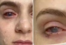 Popila tabletu protiv bolova koju uzimaju mnogi, a onda joj se život zauvijek promijenio - featured image