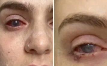 Popila tabletu protiv bolova koju uzimaju mnogi, a onda joj se život zauvijek promijenio Popila tabletu protiv bolova koju uzimaju mnogi, a onda joj se život zauvijek promijenio - featured image