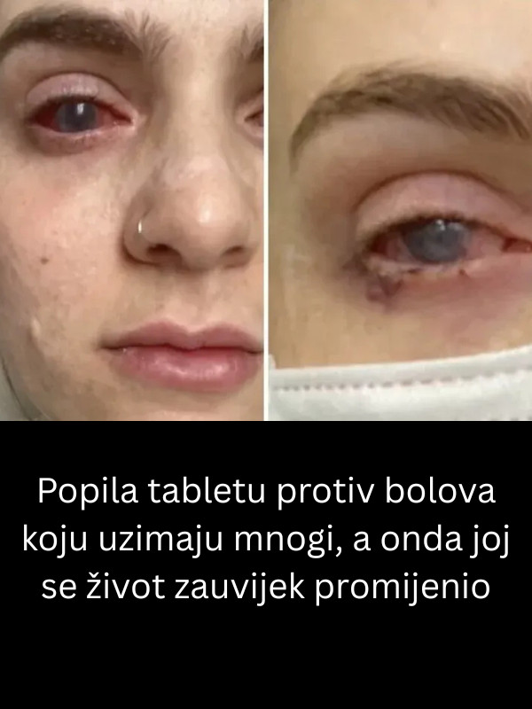 Popila tabletu protiv bolova koju uzimaju mnogi, a onda joj se život zauvijek promijenio - featured image