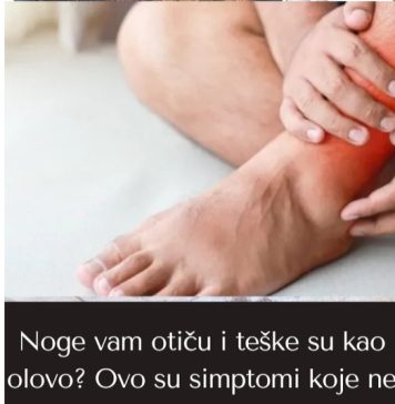 Noge vam otiču i teške su kao olovo? Ovo su simptomi koje ne smijete da ignorišete Noge vam otiču i teške su kao olovo? Ovo su simptomi koje ne smijete da ignorišete - featured image