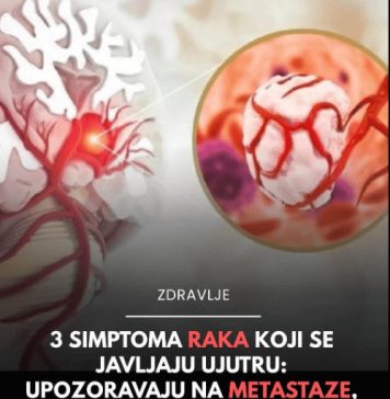 NE IGNORIŠITE IH: Možda su neprijatni, ali ovo su prvi simptomi raka debelog crijeva - featured image