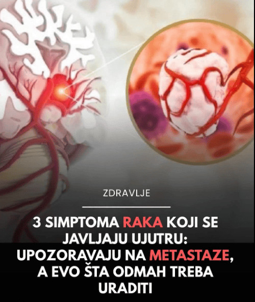 NE IGNORIŠITE IH: Možda su neprijatni, ali ovo su prvi simptomi raka debelog crijeva - featured image