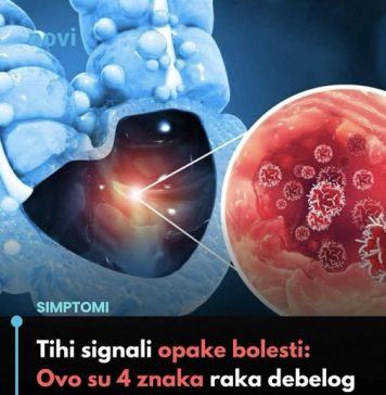 Tihi signali opake bolesti: Ovo su 4 znaka raka debelog crijeva koje tijelo šalje mjesecima prije - featured image
