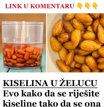 KISELINA U ŽELUCU: Evo KAK0 da se riješite kiseline tako da se 0NA više ne vraća… - featured image