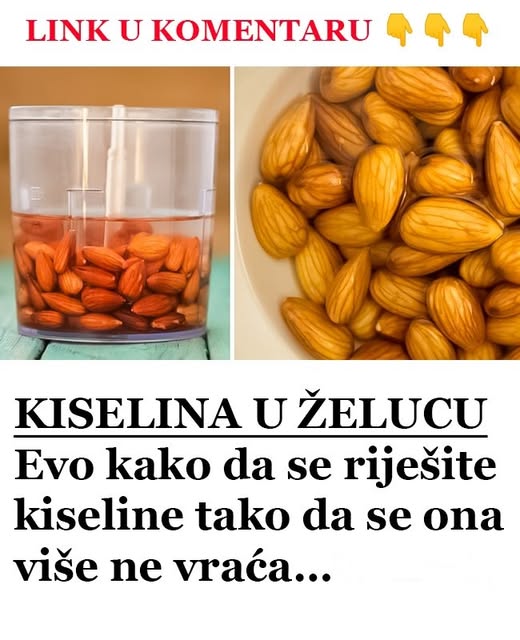 KISELINA U ŽELUCU: Evo KAK0 da se riješite kiseline tako da se 0NA više ne vraća… - featured image
