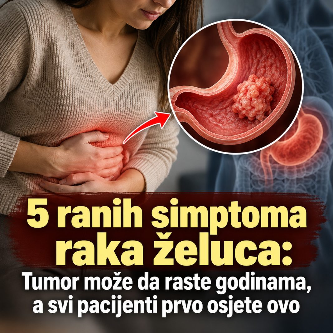 5 ranih simptoma raka želuca: Tumor može da raste godinama, a svi pacijenti prvo osjete ovo - featured image