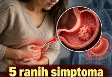5 ranih simptoma raka želuca: Tumor može da raste godinama, a svi pacijenti prvo osjete ovo - featured image