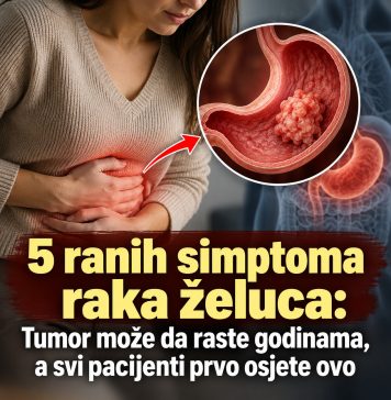 5 ranih simptoma raka želuca: Tumor može da raste godinama, a svi pacijenti prvo osjete ovo - featured image