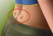 DISKUS HERNIJA: Ovaj DOMAĆI LIJEK potpuno OBNAVLJA KIČMU, JAČA JE I LIJEČI - featured image