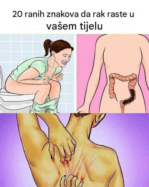 OBRATI PAŽNJU: Ovo su 20 ranih znakova da se vaše tijelo bori protiv raka 👇 - featured image