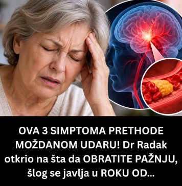 OVA 3 SIMPTOMA PRETHODE MOŽDANOM UDARU! Dr Radak otkrio na šta da OBRATITE PAŽNJU, šlog se javlja u ROKU OD… - featured image