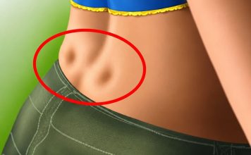 DISKUS HERNIJA: Ovaj DOMAĆI LIJEK potpuno OBNAVLJA KIČMU, JAČA JE I LIJEČI