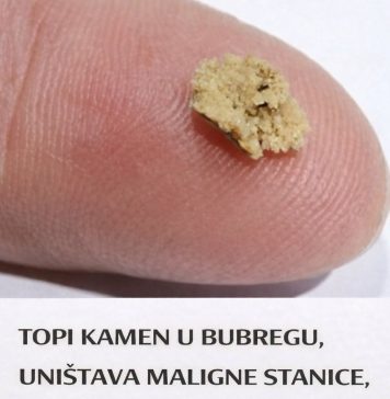 TOPI KAMEN U BUBREGU, UNIŠTAVA MALIGNE STANICE, ČISTI JETRU: Ovo je najzdraviji čaj na svijetu!